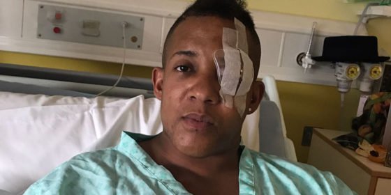 This 37-year-old was blinded in one eye after horrific attack in London