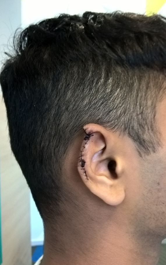 Man gets ear bitten off looking at his genitals-2